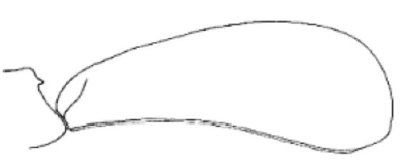 ♂ metasoma in lateral view