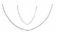 posterior end of carapace in ventral view