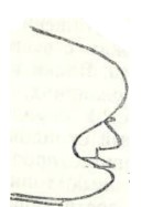 ♂ metasoma lateral view