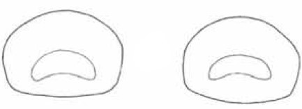 two forms of male apical foramen of carapace in facial view