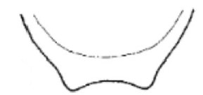 apical end of carapace in ventral view