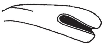 ♂ metasoma, lateral view