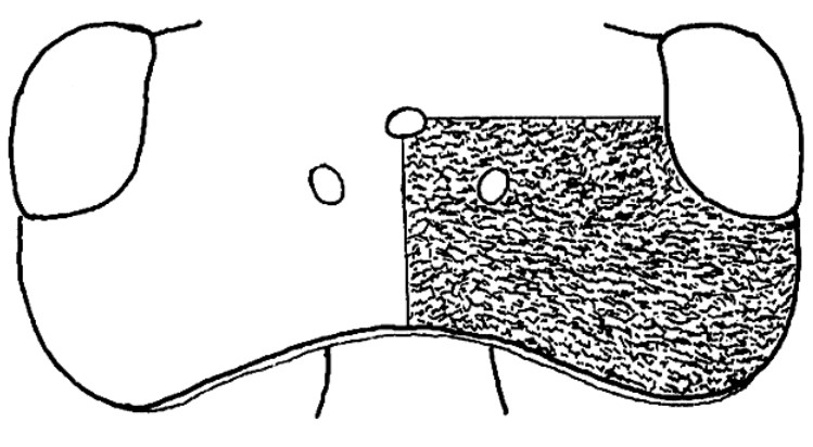 ♂ head in dorsal view