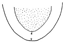 ♀ apico-ventral end of carapace